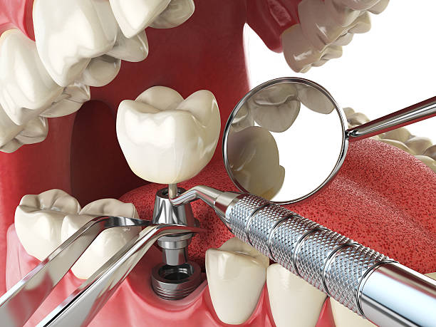 Best Orthodontic Emergency Dentist in Peachtree Corners, GA